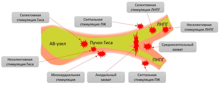Изображение статьи