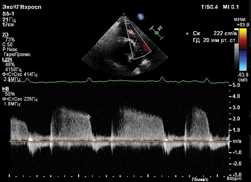 Изображение статьи