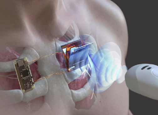 Изображение статьи