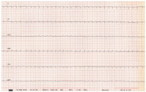Изображение статьи