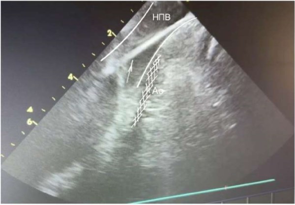 Изображение статьи