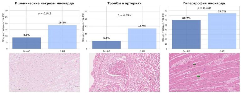 Изображение статьи