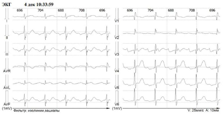 Изображение статьи
