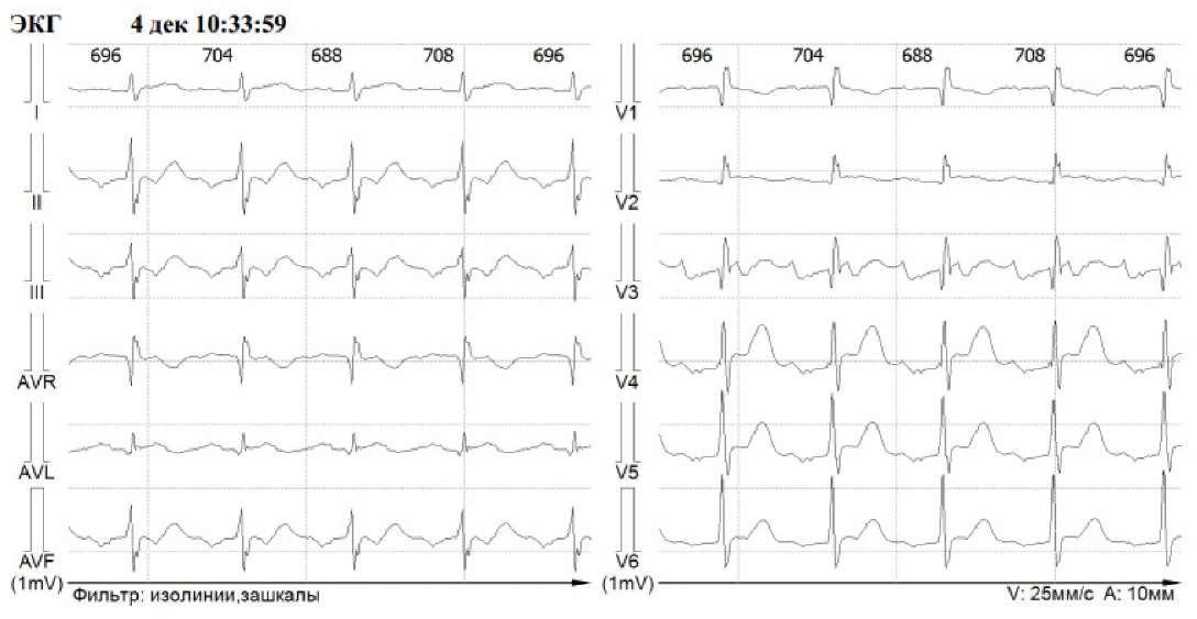 Изображение статьи