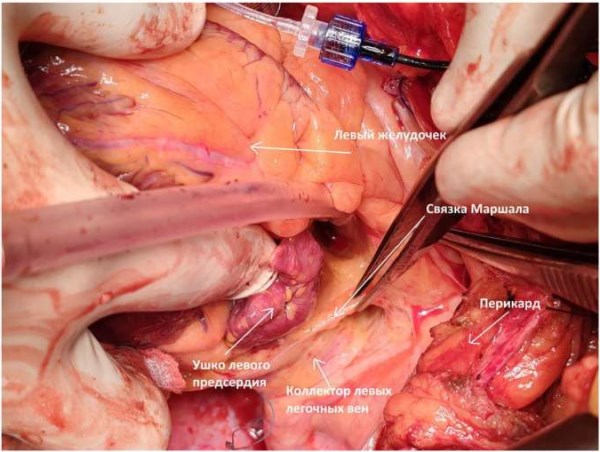 Изображение статьи